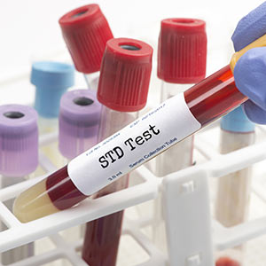 STD Treatment Clinic Near Me in Celebration, FL
